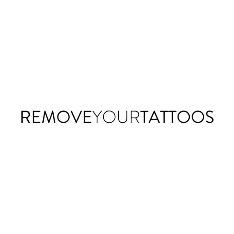 Remove Your Tattoos